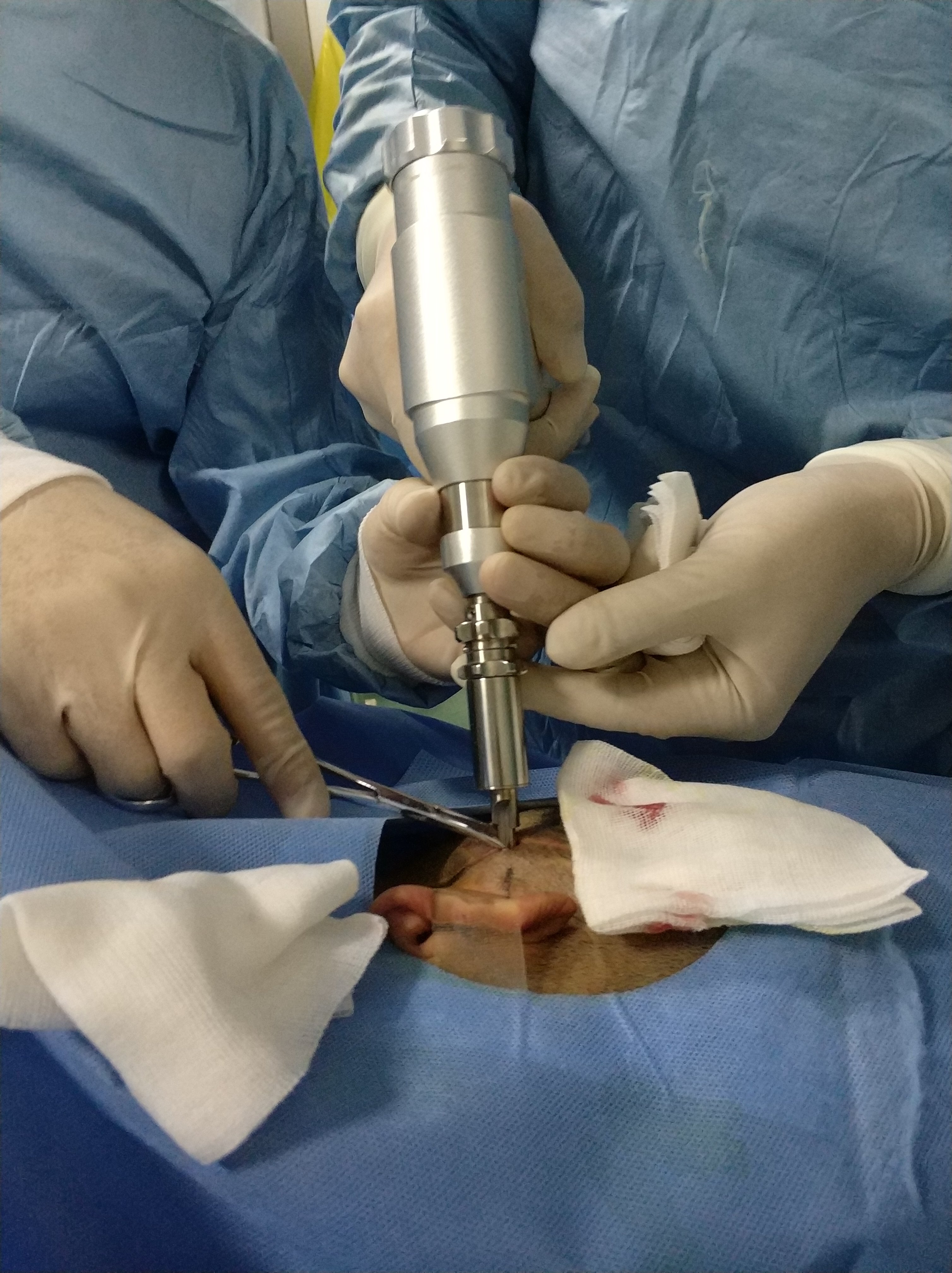 粒子植入——脑肿瘤局部精准治疗的新选择 - 好大夫在线