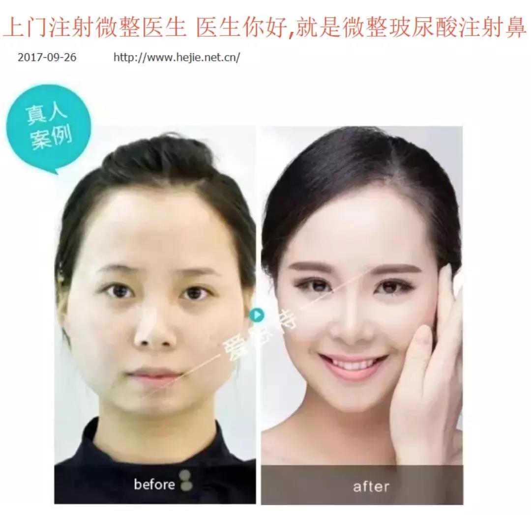 混乱的医美市场 可怕的微整形---一个整形医生