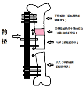 骨搬移手术原理图图片