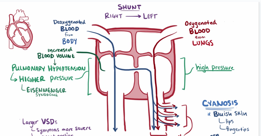 肺动脉压力增高后期出现右向左分流png