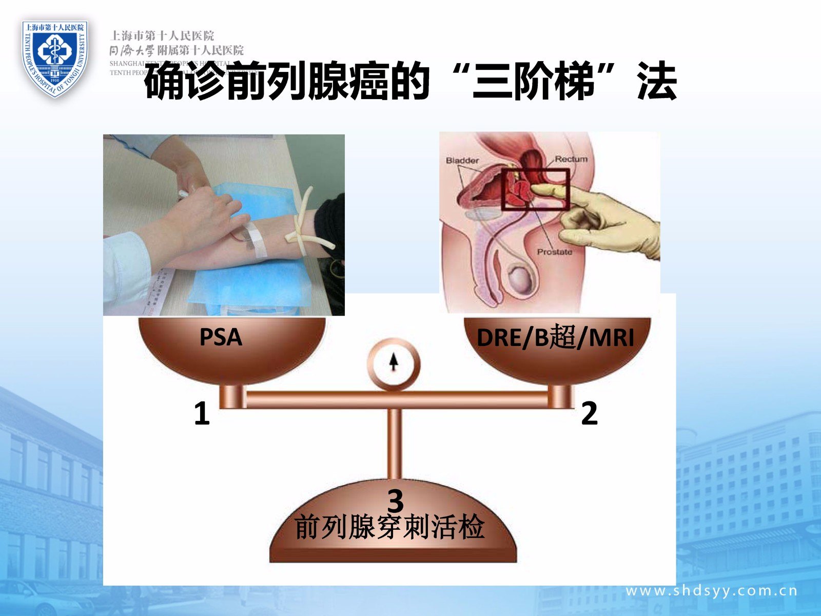 新技术介绍:前列腺癌早期诊断的融合靶向精准穿刺活检