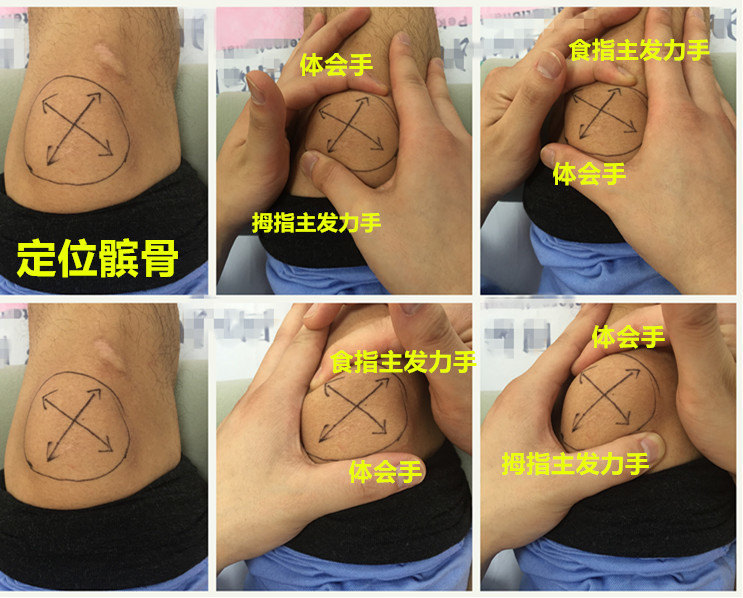 前叉术后为啥要完全恢复髌骨的活动度?