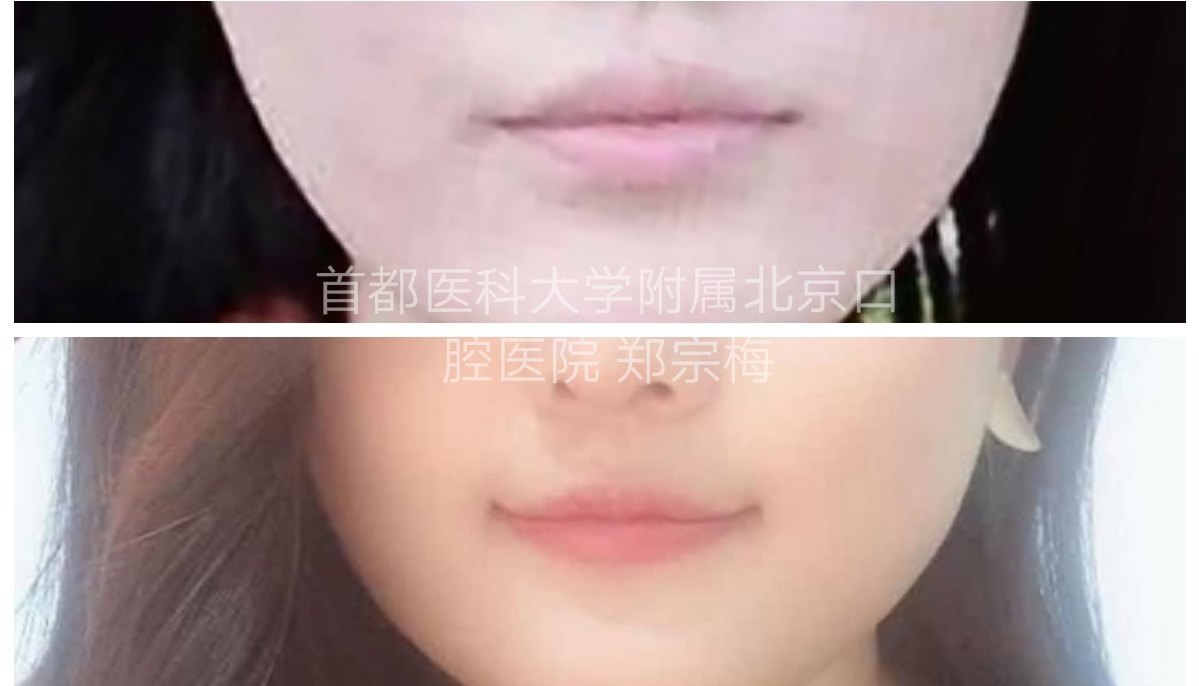 暂无