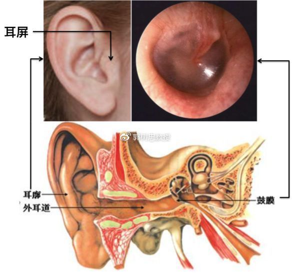 郭树忠教授:你的孩子十有八九没有外耳道
