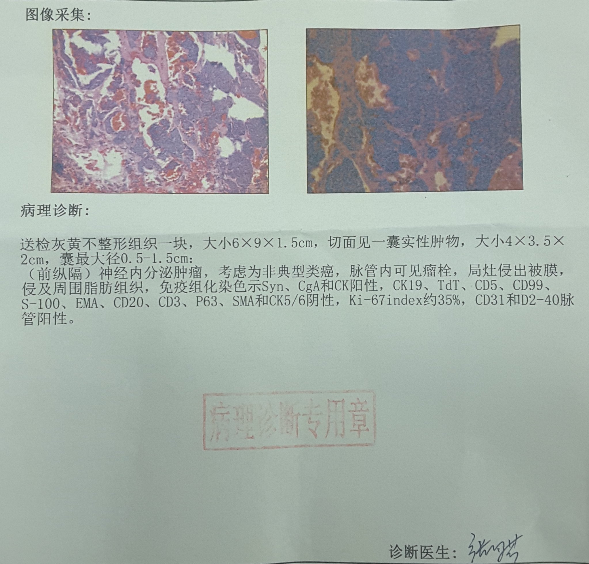 暂无