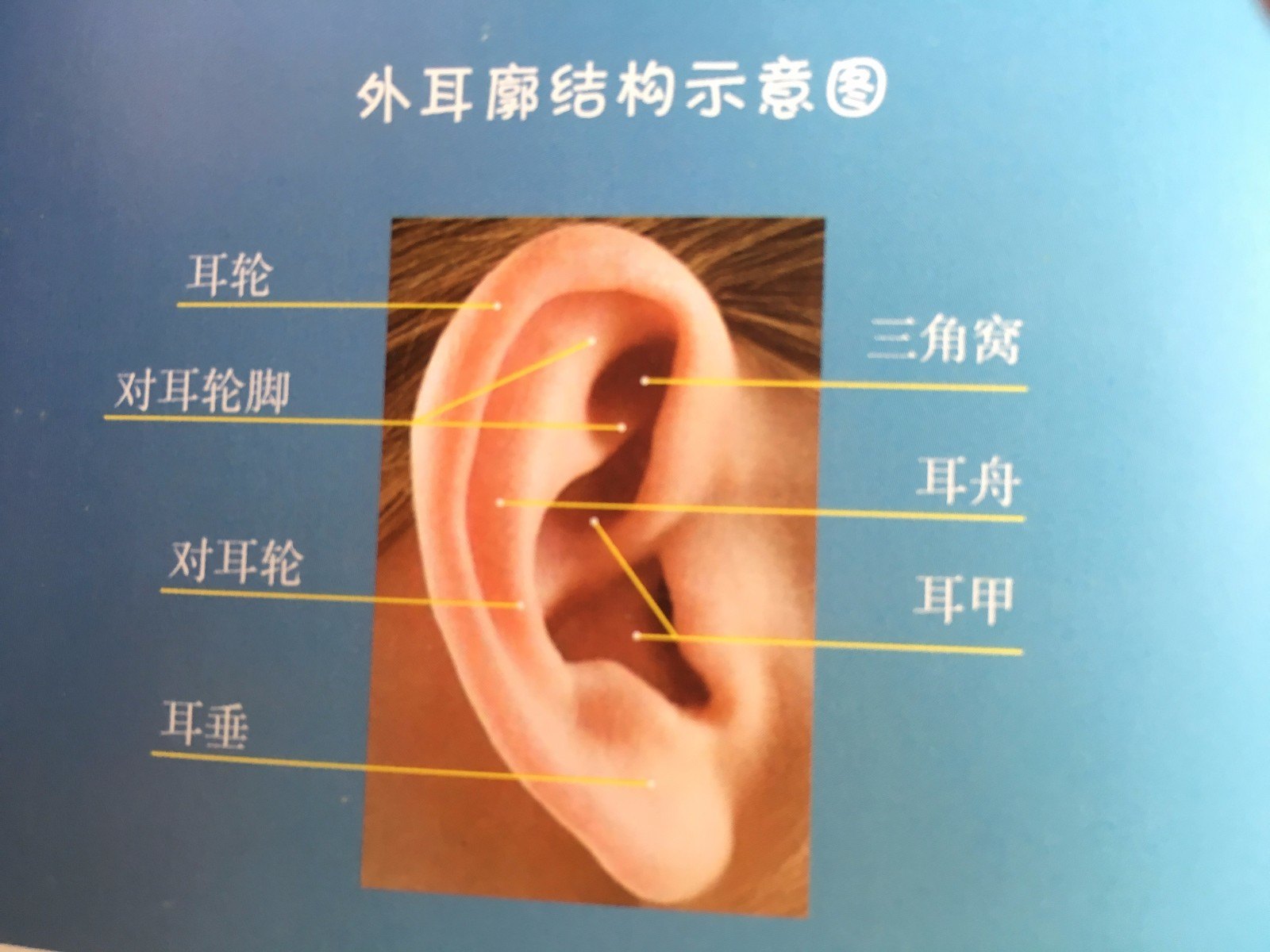先天性耳廓畸形耳模矫正技术专家共识