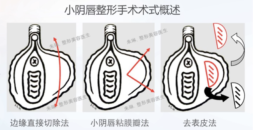 女生皮皮过长图片图片