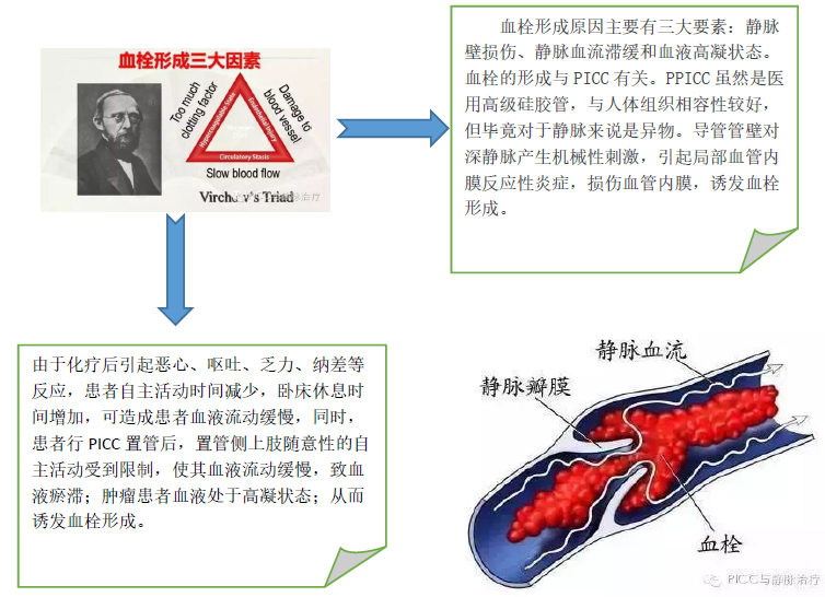 picc置管后出现静脉血栓应注意什么? - 好大夫在线