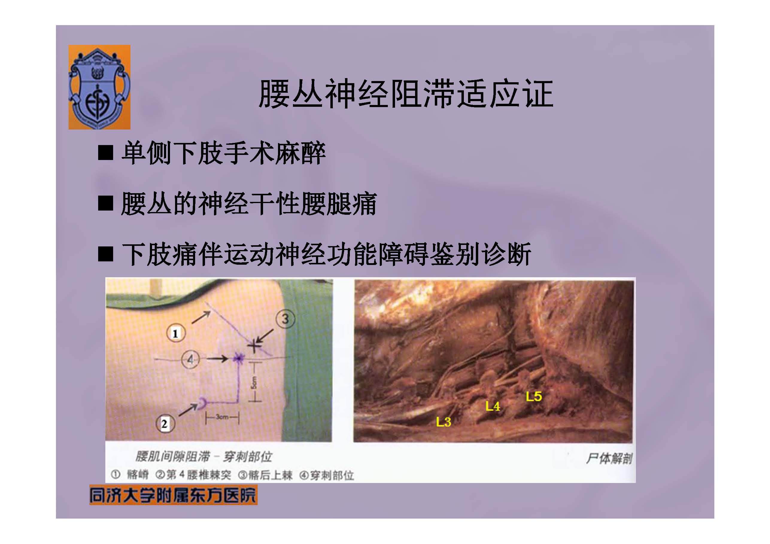 腰丛神经阻滞,腰丛,坐骨阻滞_大山谷图库
