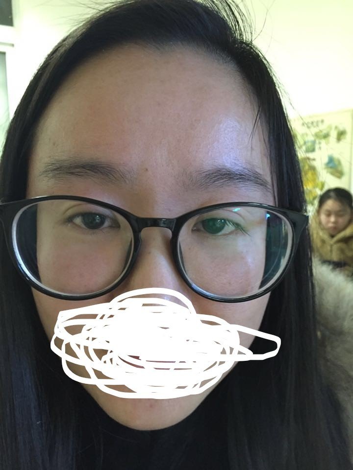 你换了大镜框却无意中害了自己的眼睛