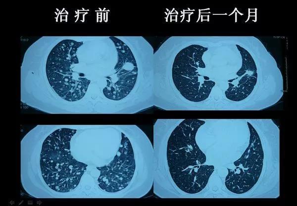 1522038000363236.jpg 微信图片_20180326121847.jpg