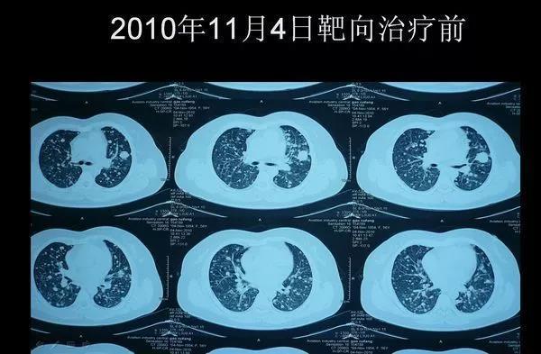 1522037988751815.jpg 微信图片_20180326121843.jpg