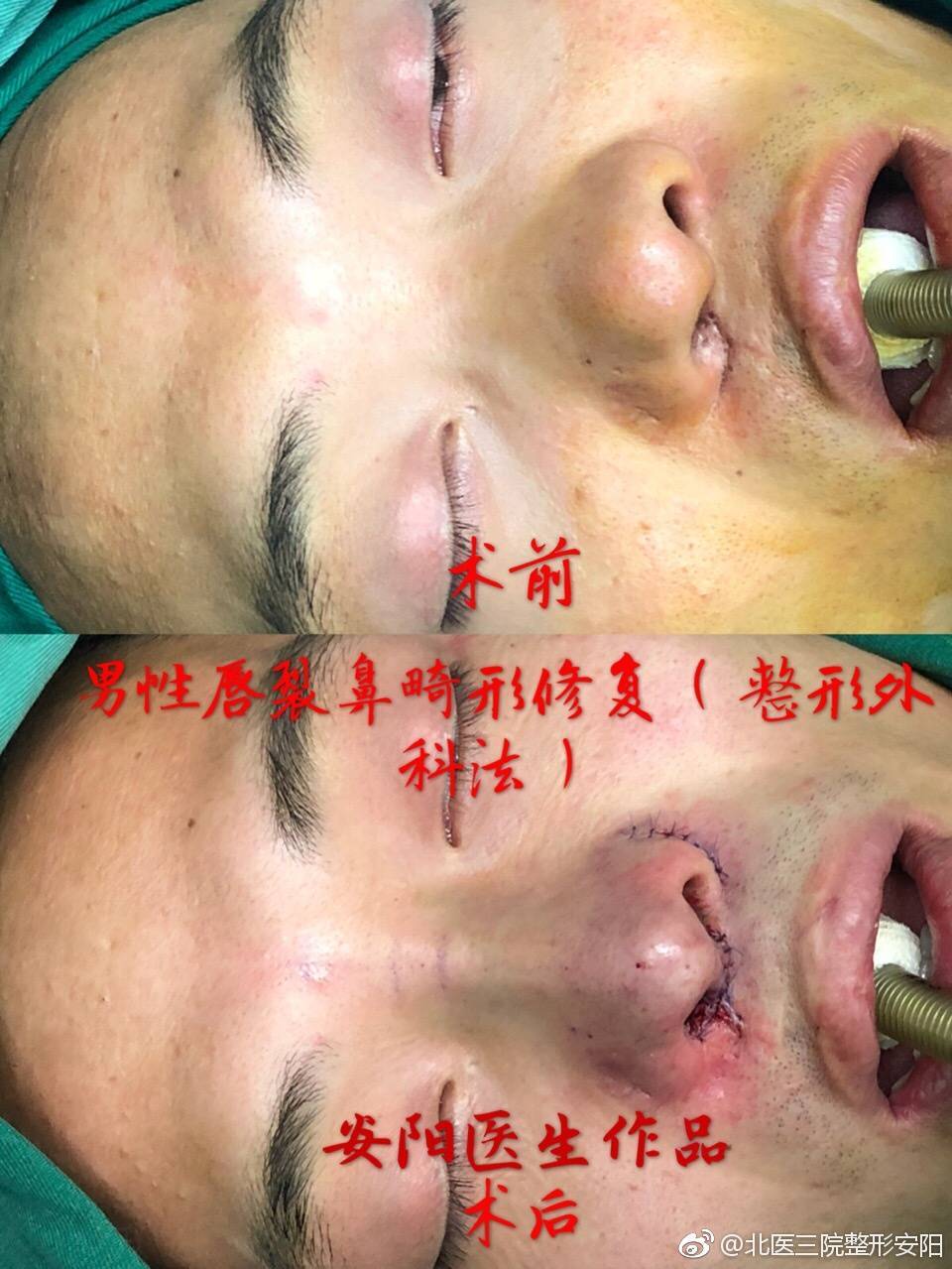 暂无