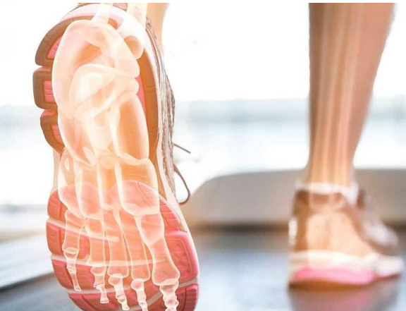 足底筋膜炎是脚跟痛的主要原因