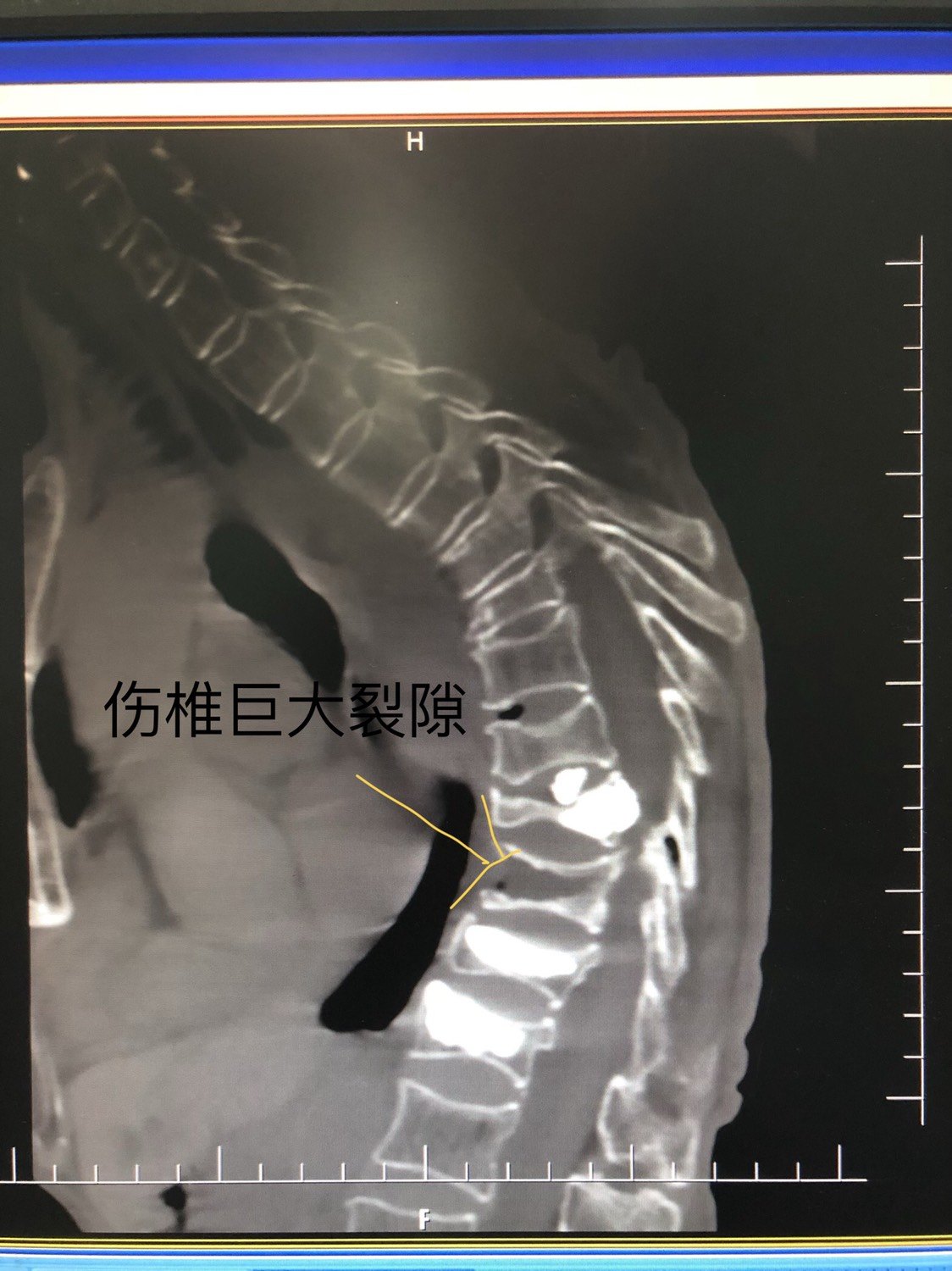 暂无