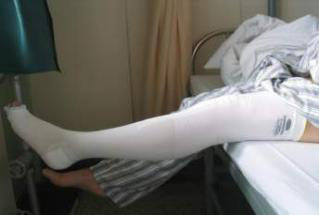 1531724126531484.png 医用弹力袜.png