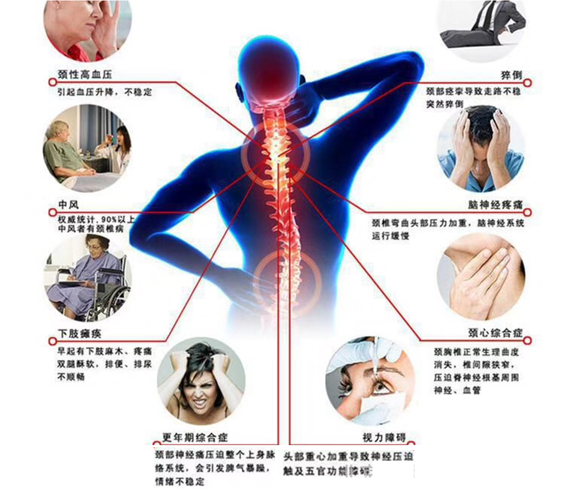 骨刺的原理_根据骨刺产生的原理,错误的力学分布是加速其发生发展的罪魁祸首,所以在日常生