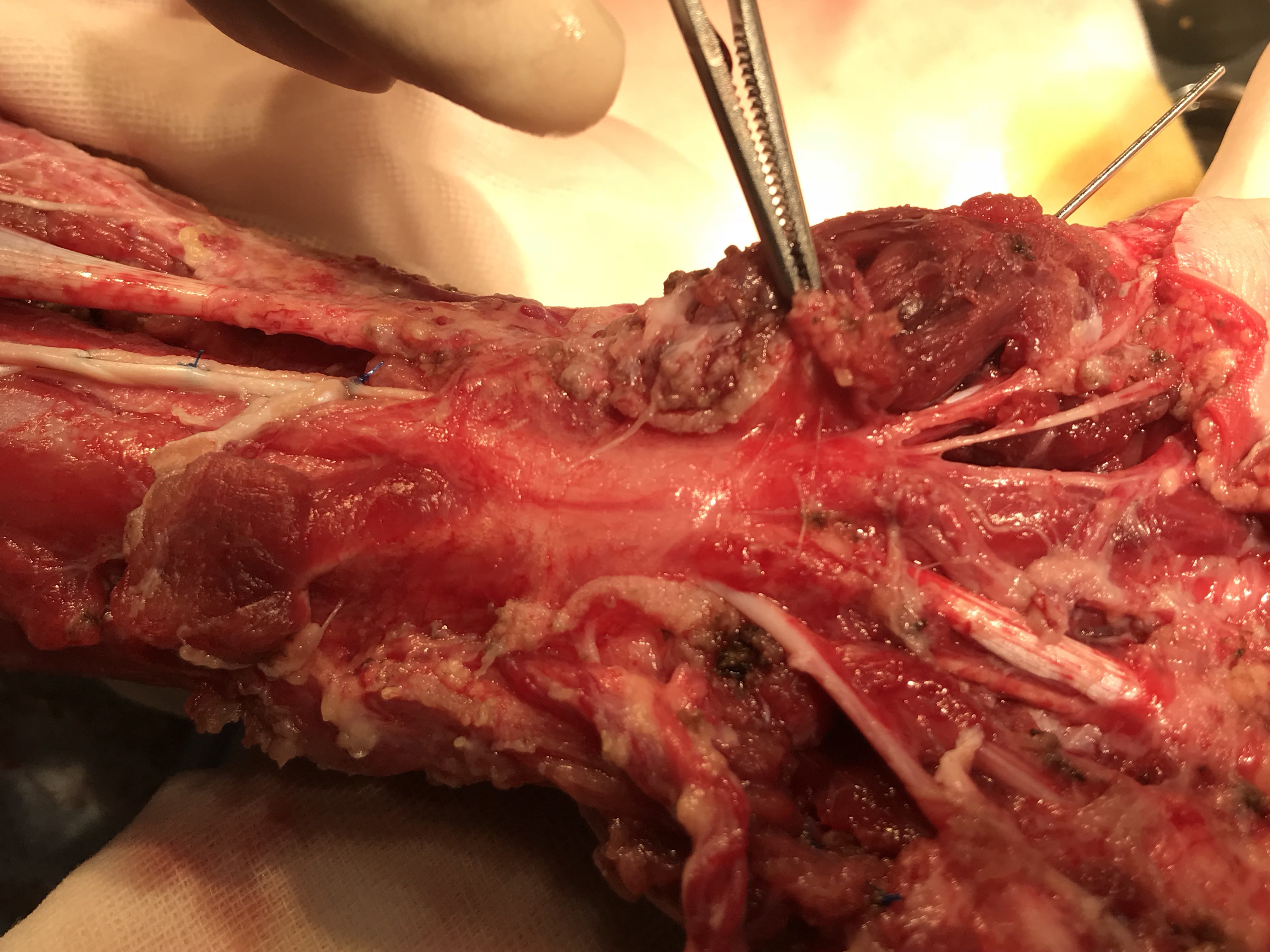 皮肤撕脱伤的治疗 - 好大夫在线