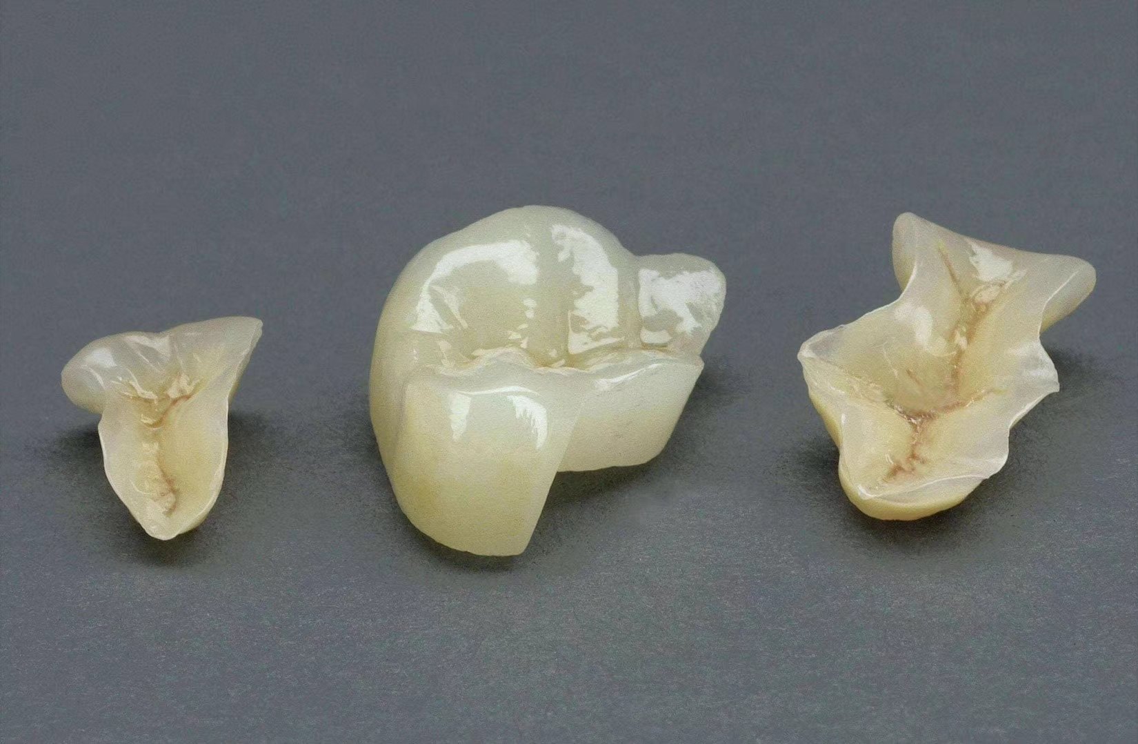 【嵌体——您的私人定制】 - 好大夫在线