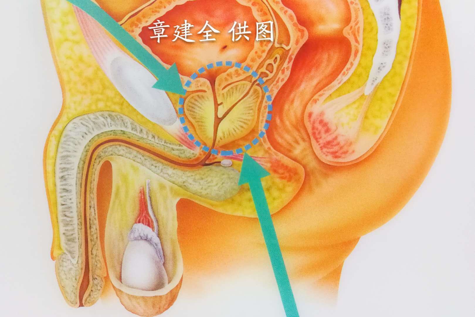 精囊腺解剖位置图片