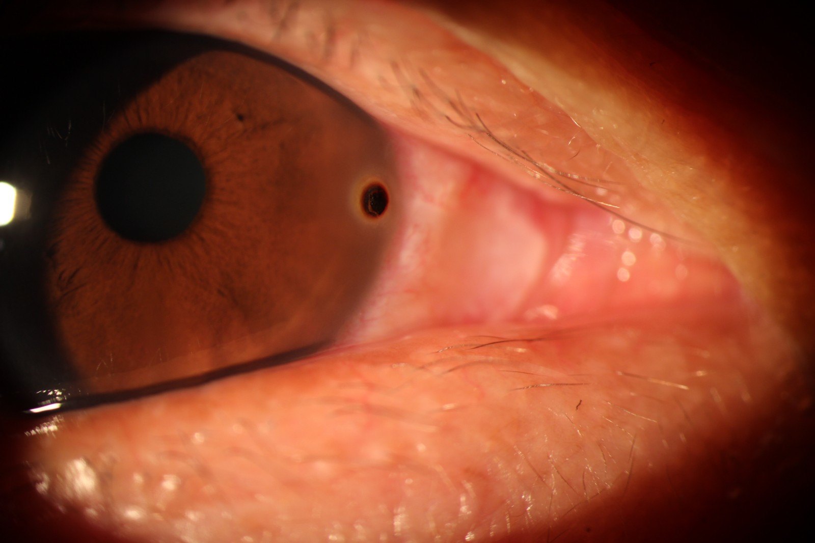 不幸被"贱货"击中的眼睛们(图) - 好大夫在线