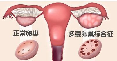 暂无