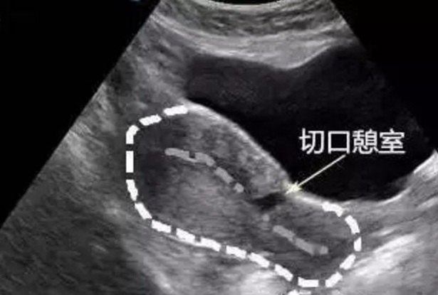 暂无