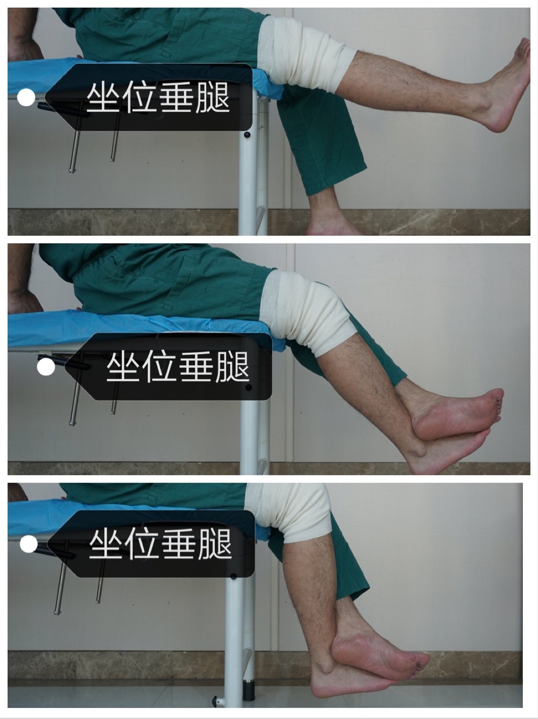 膝关节前交叉韧带重建术后功能锻炼 