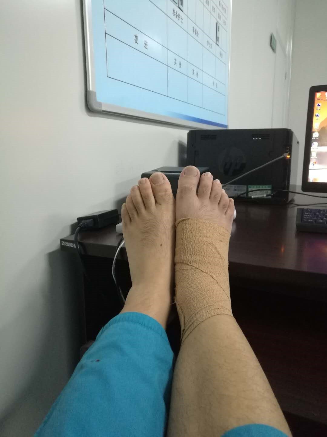 踝关节扭伤后怎么办--------一名医生自述的恢复过程_踝部扭伤_康复