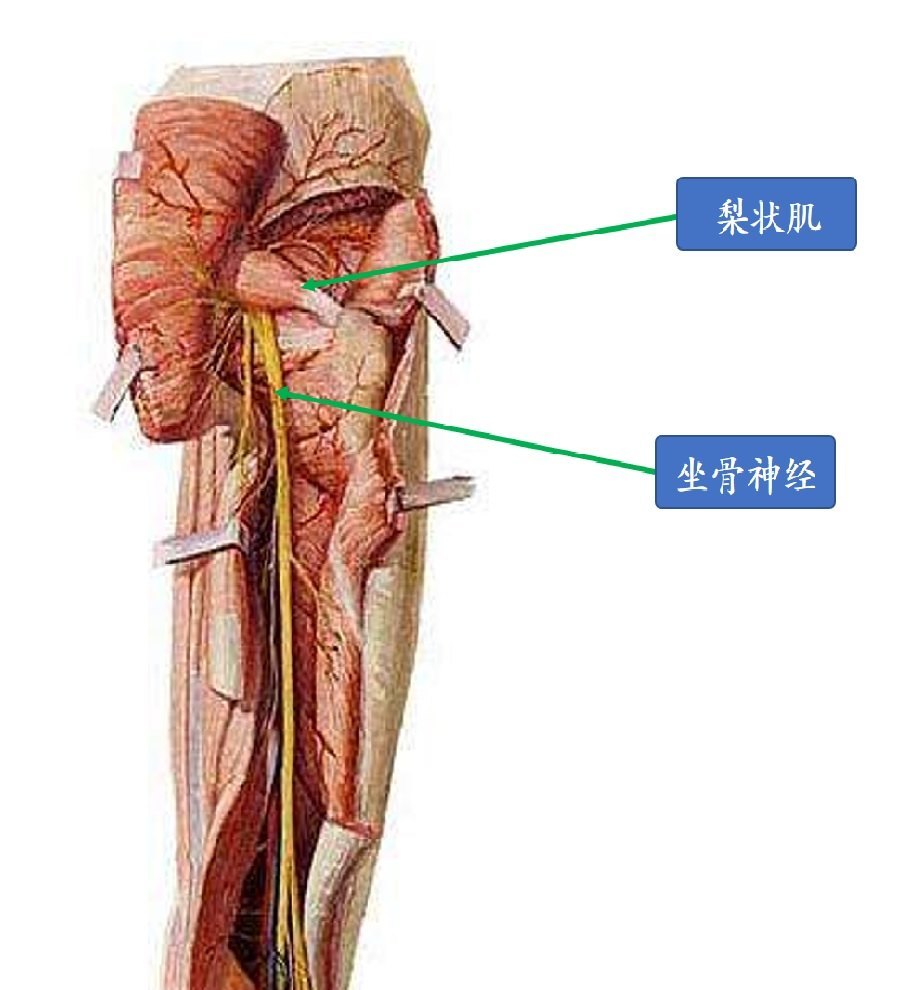 梨状肌解剖位置图片