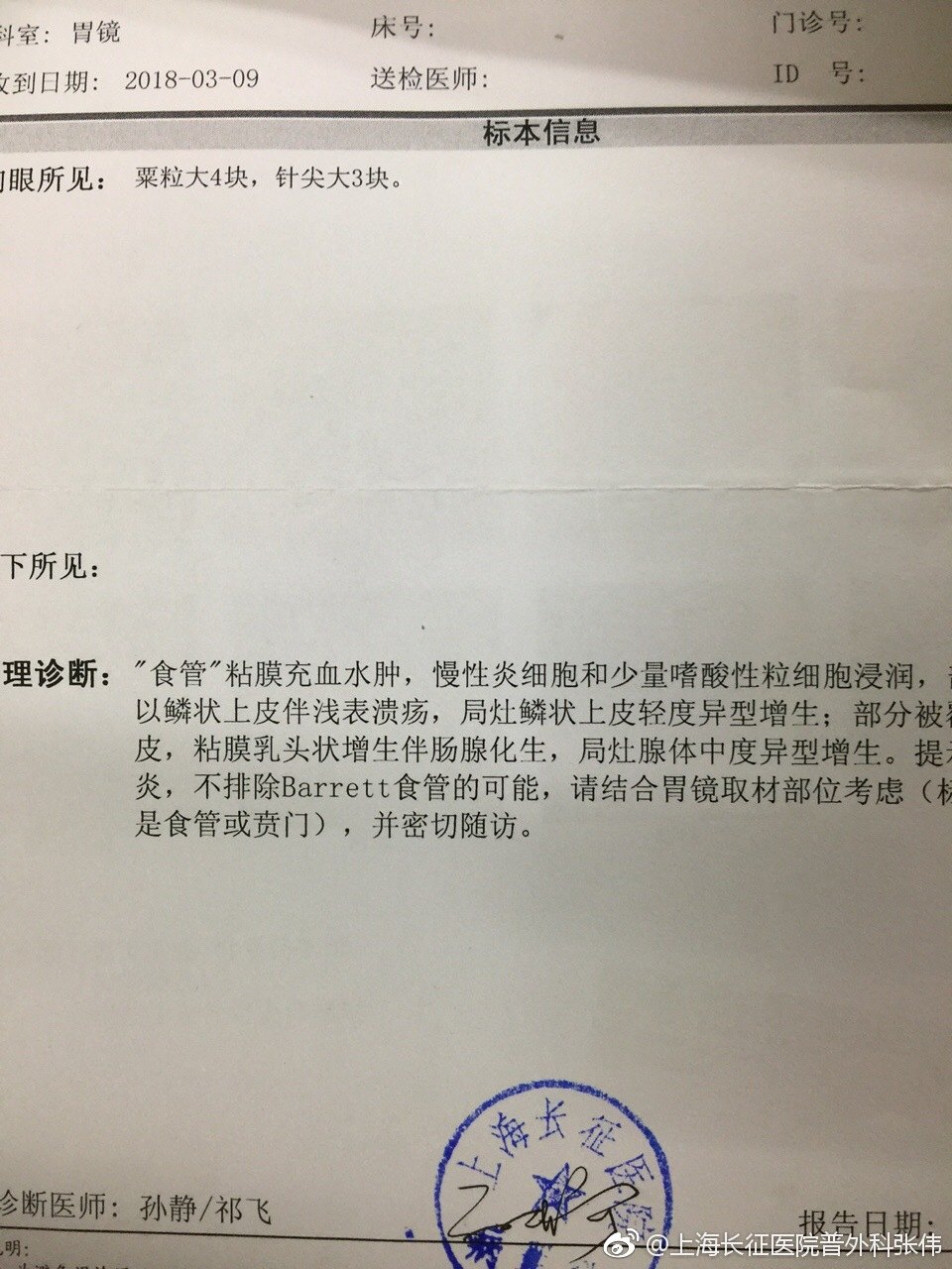 食管裂孔疝,早治效果好