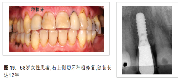 屏幕快照 2018-05-31 上午10.53.39.png