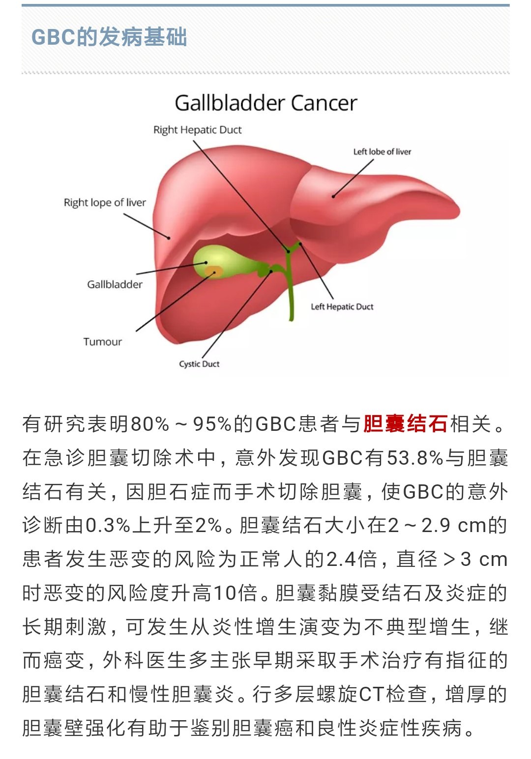 膽囊炎的發病機制