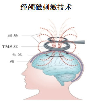 经颅磁ppt图片