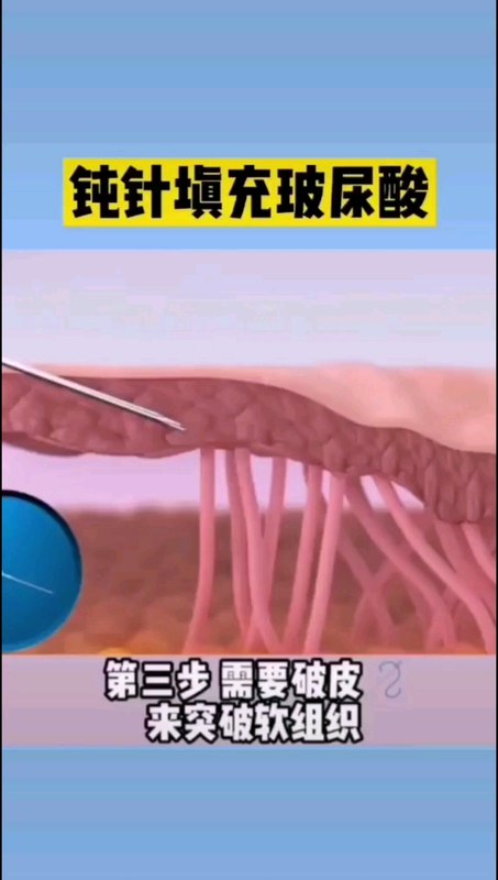 視頻封面