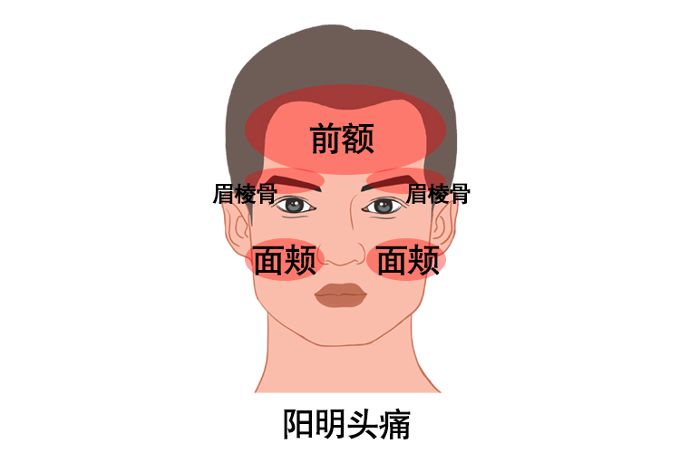 六经头痛位置图_头痛_头痛介绍 - 好大夫在线