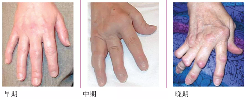 圖文圖片