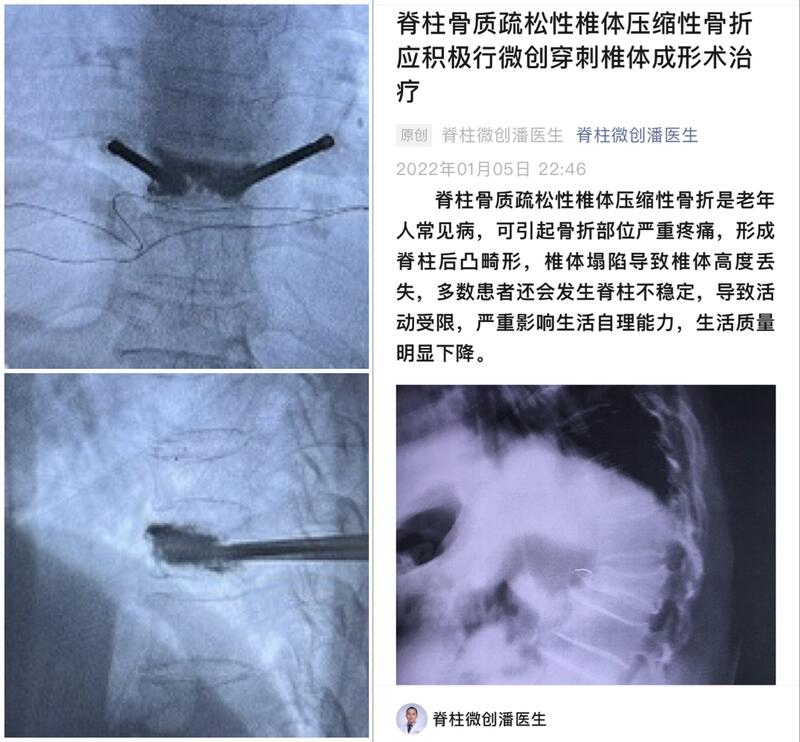 圖文圖片