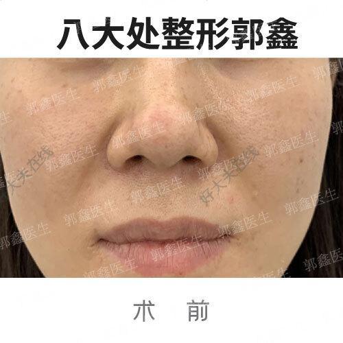 圖文圖片