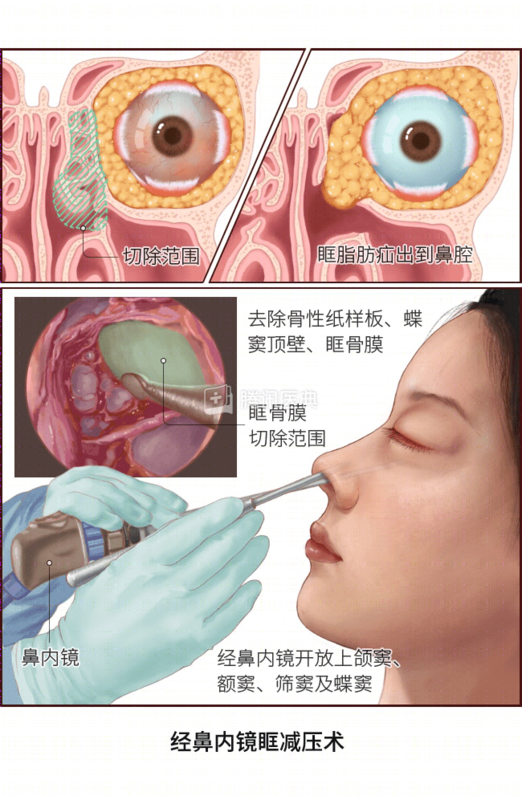 圖文圖片