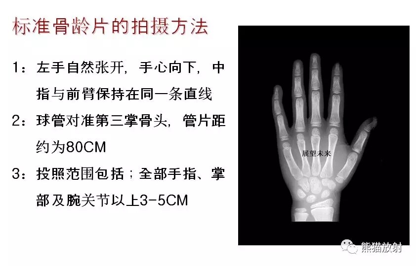 小多角骨突出图片