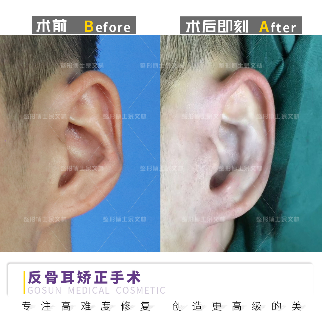 耳朵反骨的男人图片图片