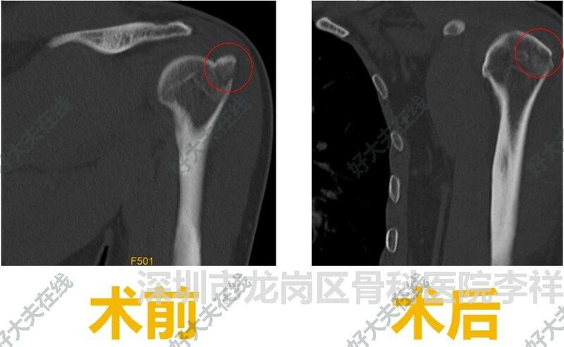 圖文圖片