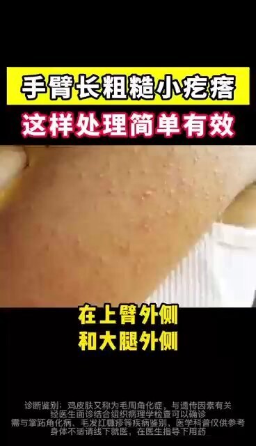 視頻封面