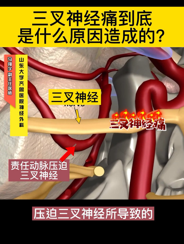 視頻封面