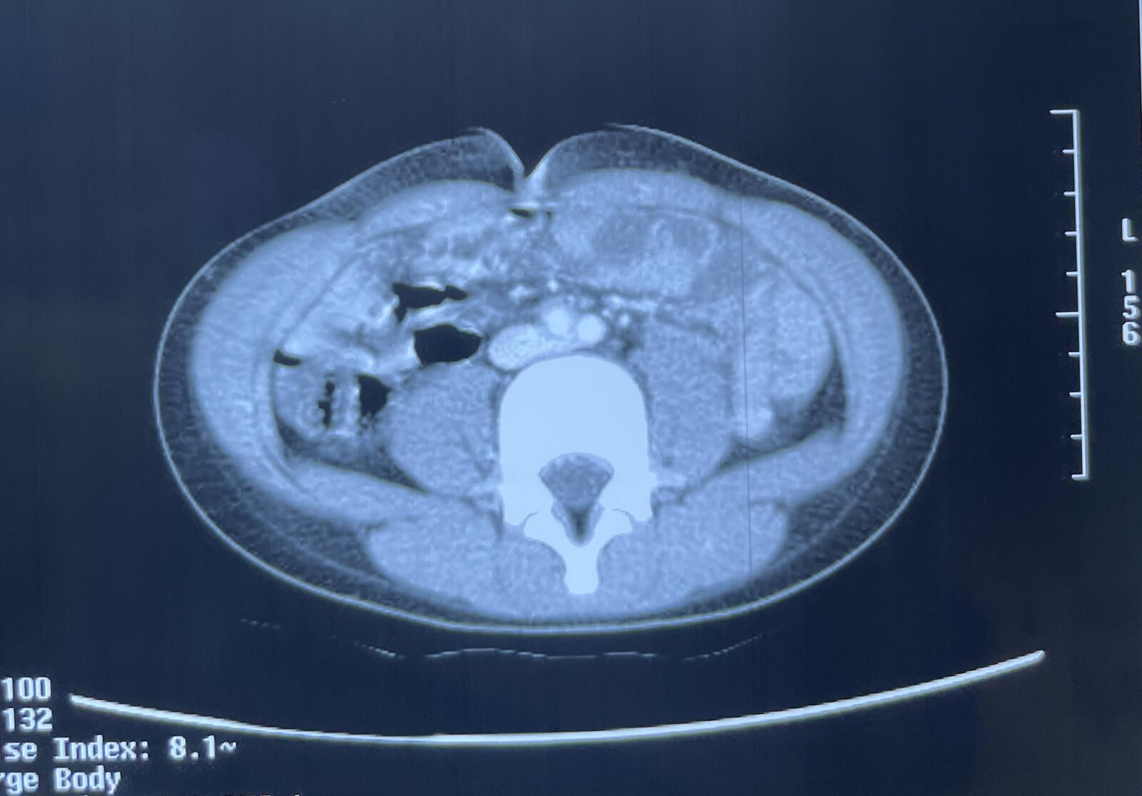 图3-31 肠系膜下淋巴结-基础医学-医学