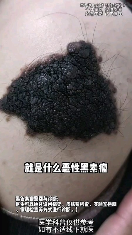 視頻封面