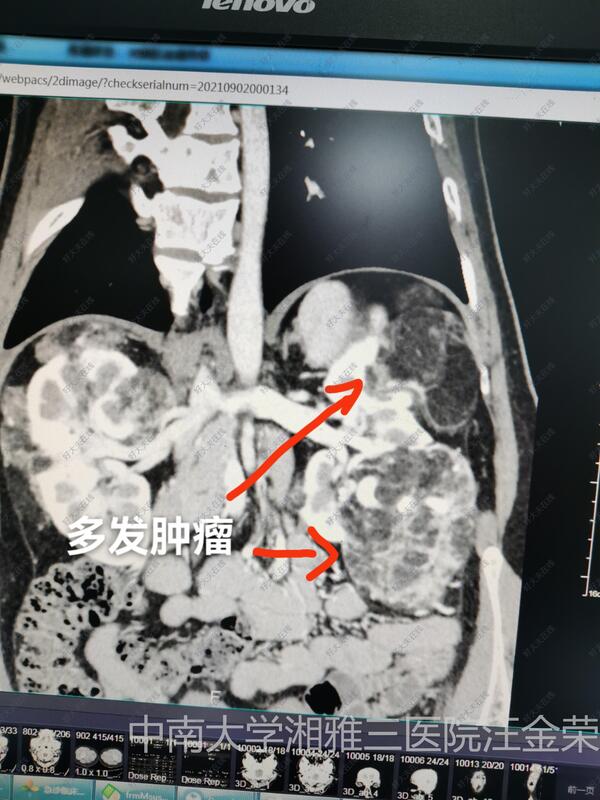 圖文圖片
