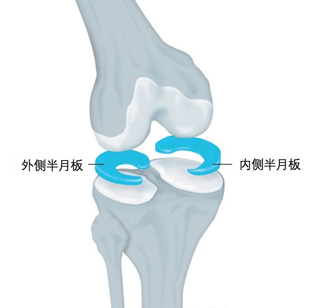 半月板损伤那点事 上 膝关节半月板损伤 好大夫在线 半月板损伤那点事 上 膝关节半月板损伤 好大夫在线