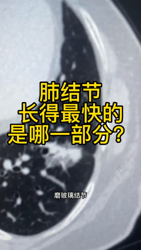視頻封面